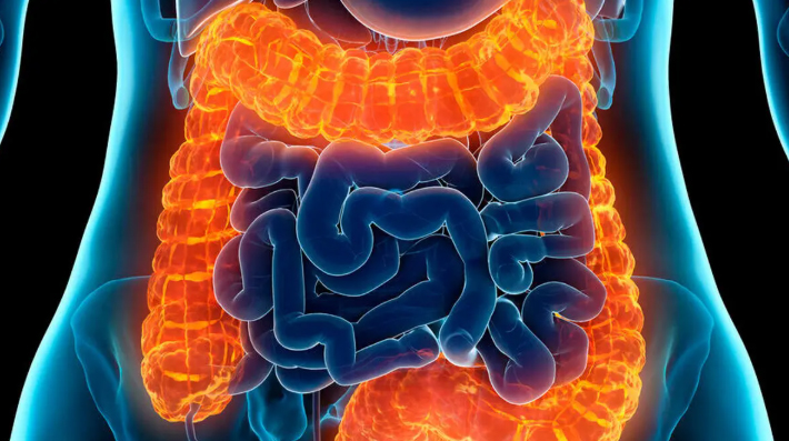 علماء صينيون يكشفون عن سبب محتمل لالتهاب القولون التقرحي