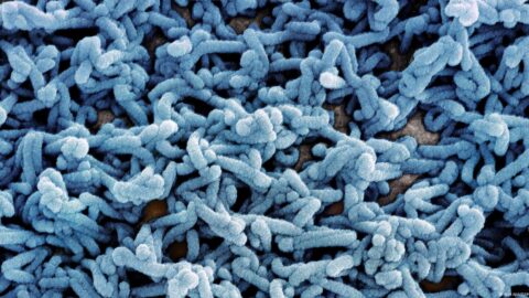 السلطات الإثيوبية تؤكد تفشي وباء “ماربورغ” في جنوب البلاد