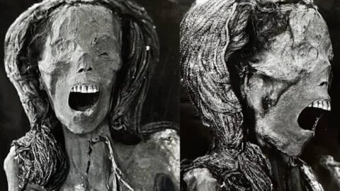 علماء يكتشفون خضوع امرأة لجراحة متقدمة في الفك السفلي قبل 2500 عام